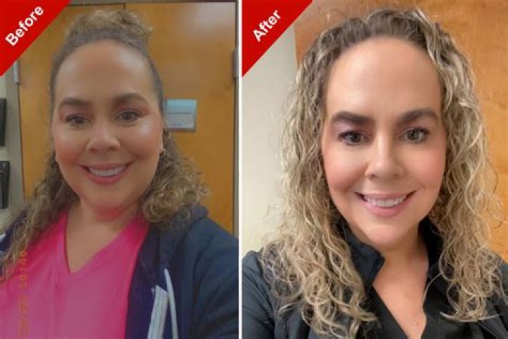 Before And After Pictures Revealed