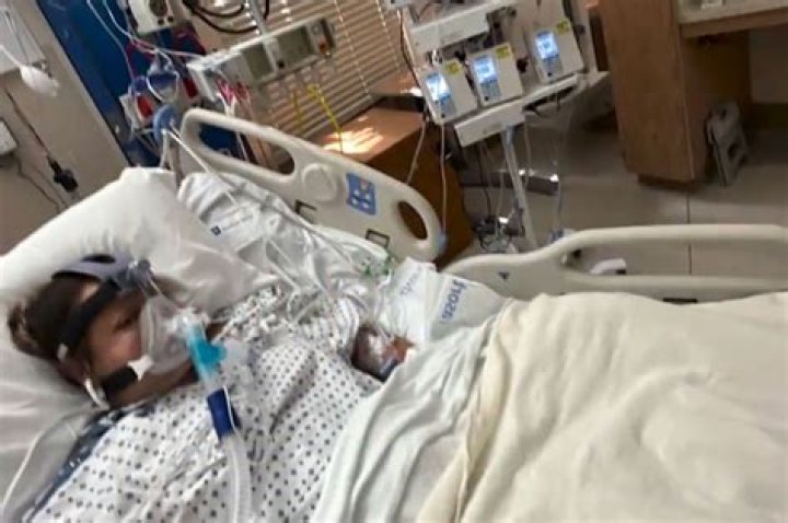 California woman has all four limbs amputated after eating bad tilapia