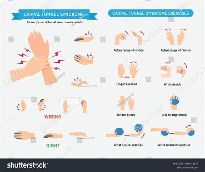 Carpal Tunnel Exercises Could Be Making It Worse