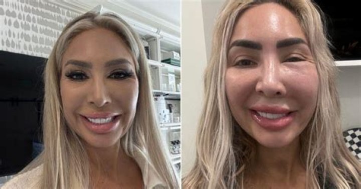 Farrah Abraham's Plastic Surgery Confession: Insights And Impact