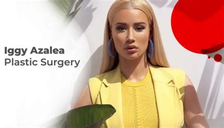 Iggy Azaleas Plastic Surgery Noticeable In Artwork For New Single Hollywood Life