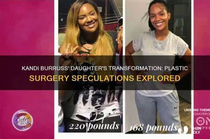 Kandi Burruss Plastic Surgery: Procedures, Costs, and More