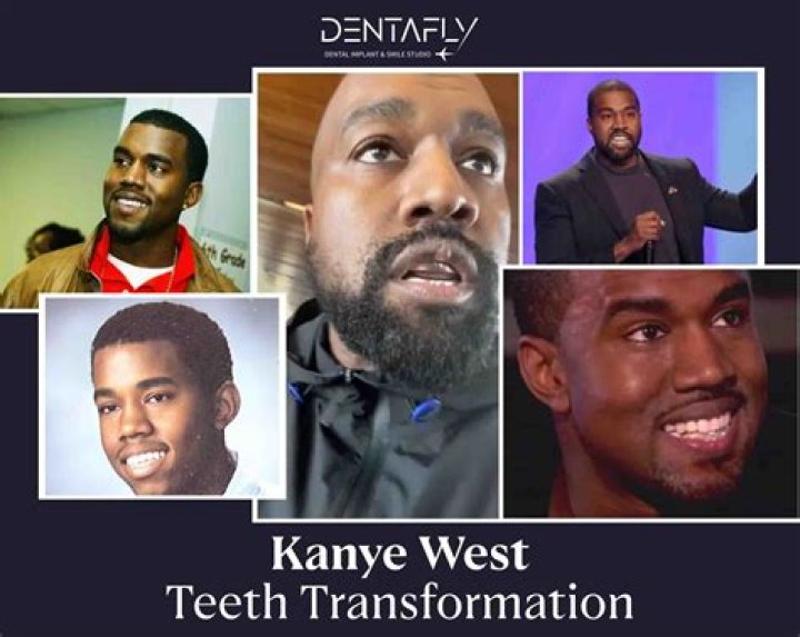 Kanye West: A Transformation Beyond Music