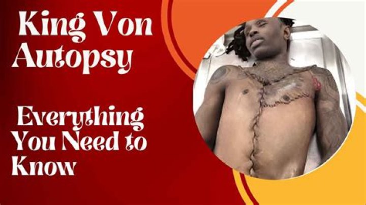 King Von Autopsy Report: Graphic Photos And Findings