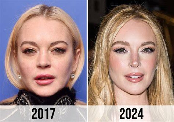 Lindsay Lohan's Plastic Surgery Transformation: A Closer Look