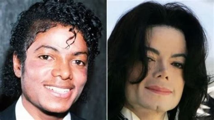 Michael Jackson Before and After Plastic Surgery and Transformation ·
