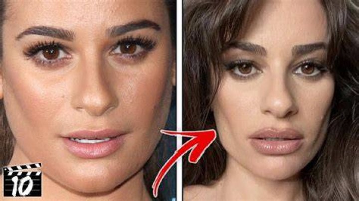 People can't stop talking about the cheek fat removal surgery that's sweeping Hollywood. We asked pl |