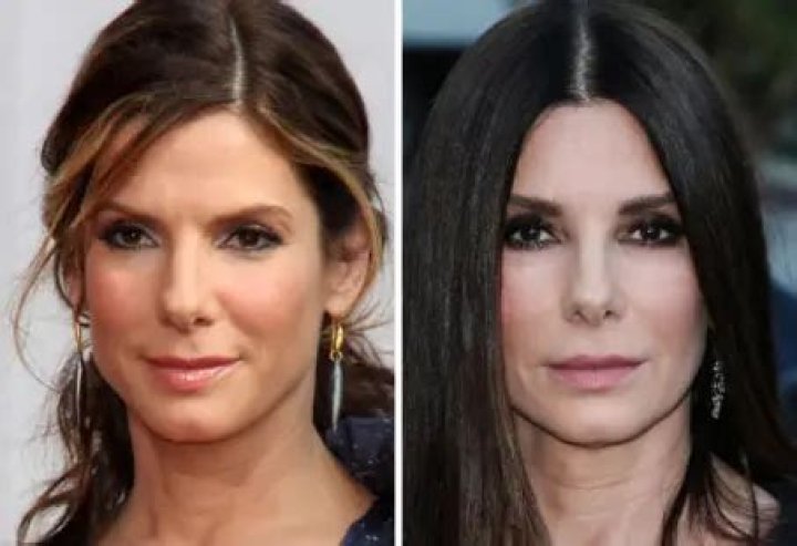 Sandra Bullock's Plastic Surgery Journey Revealed