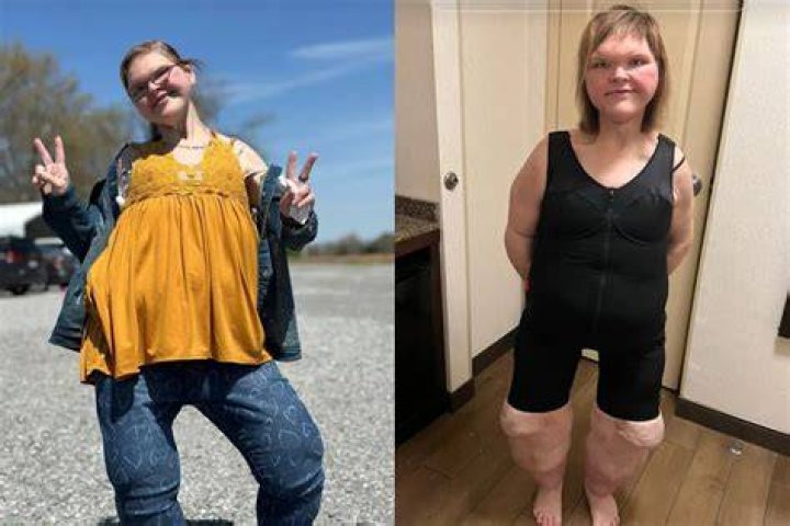 Tammy Slaton now looks unrecognizable in 2023 after weight loss surgery ·