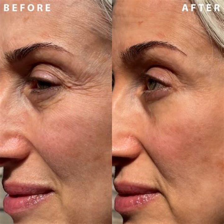 Uncover The Truth Behind Il Makiage Power ReDo Wrinkle Fix: Unlock Youthful Radiance