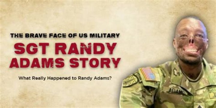 Unraveling The Truth Behind Randy Adams' Face Accident: Insights And Revelations