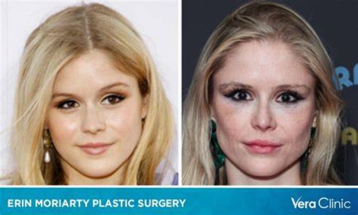 Unveiling The Truth Behind Olivia Casta's Plastic Surgery Rumors